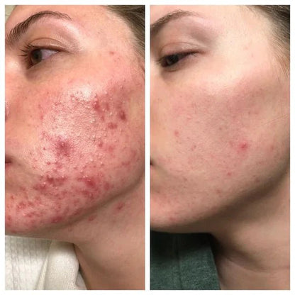 HealFlex™ Roll - Beauty Staple